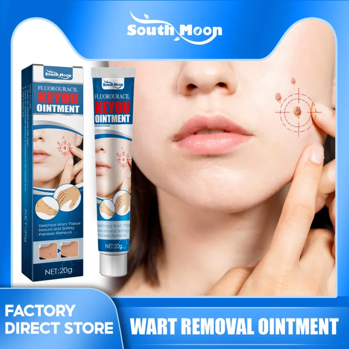 South Moon Wart Remover Ointment Mole Remover Warts Remover Original Cream Painless Wart Removal