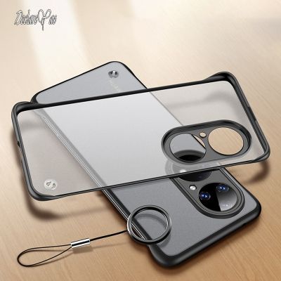 「Enjoy electronic」 P 50 40 Case DECLAREYAO Luxury Ultra Slim Plating Cover For Huawei P20 P30 P40 P50 Pro Plus Lite Case Hard Clear Matte TPU Cover