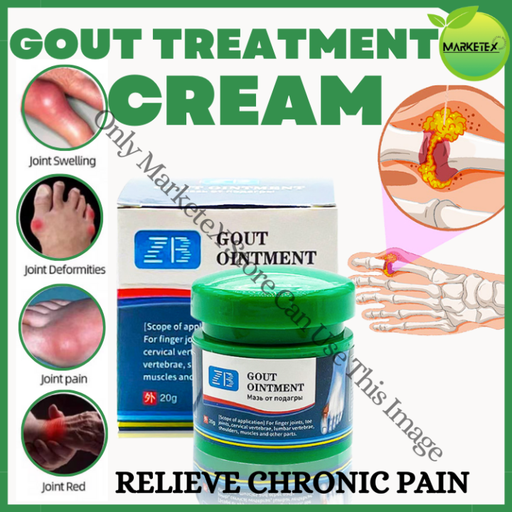 Gout Ointment Treatment Gout Cause Joint Knee Pain Toe Finger Bone Spur