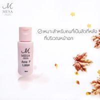 acne P lotion แป้งทาสิว แป้งสำหรับสิวที่หลังและสิวที่หน้าอก เมษาคลินิก โดยแพทย์ผิวหนัง