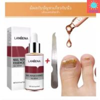 เซรั่มบำรุงเล็บ Lanbena ของแท้ 100% น้ำยาบำรุงเล็บ ขนาด15ml ต่อต้านการติดเชื้อรา ซ่อมแซมเล็บแตก เล็บเปราะ เล็บหนา