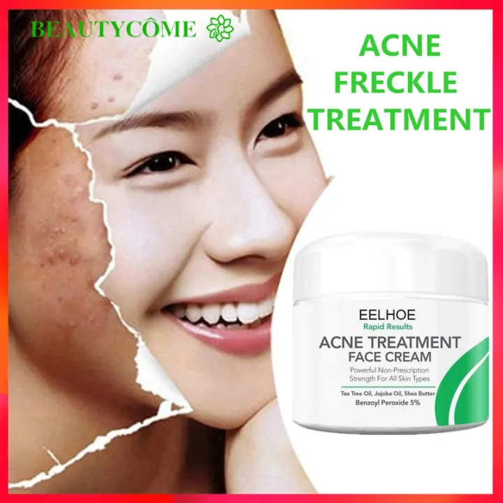 beautycome-acne-treatment-cream-anti-acne-scar-cream-whitening-repair