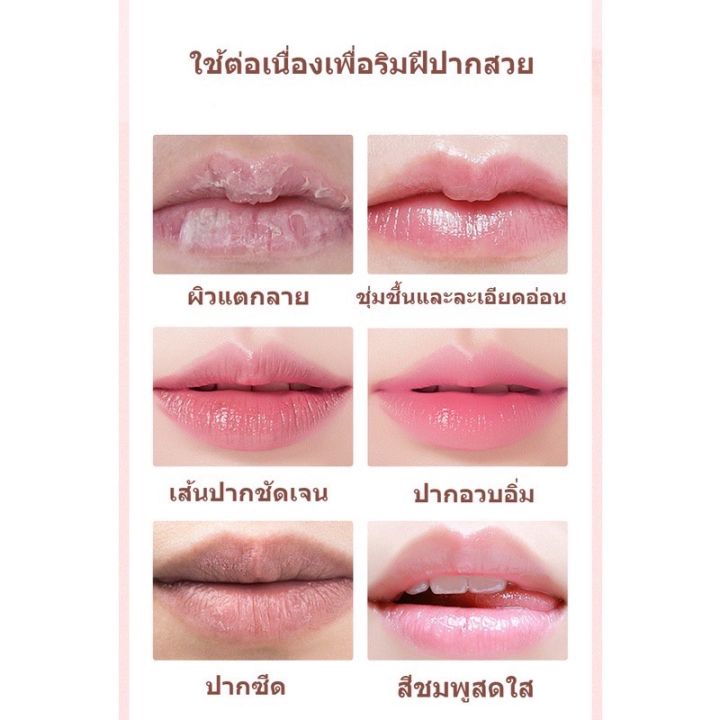 ลิปบาล์มบํารุงริมฝีปาก-ช่วยให้ความชุ่มชื้น-ลดรอยคล้ําs869