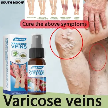 Medical Varicose Veins Treatment Leg Acid Bilges Itching Earthworm