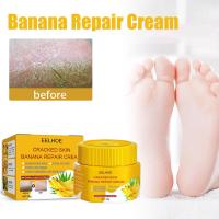 EELHOE Anti Crack Foot Cream Removal Dead Skin Cracked Repair Banana Repair Anti-Freeze Skin Cream F8S4