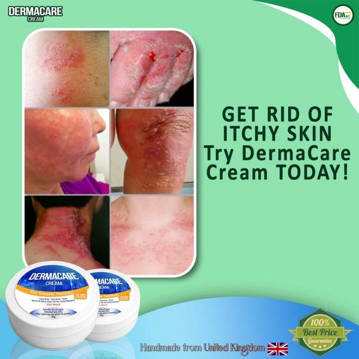 DERMACARE CREAM BLUE VARIANT- Treatments For Eczema - Psoriasis - Dry ...