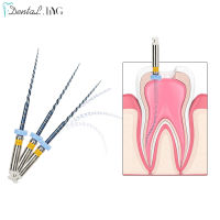 6ชิ้นกล่อง Niti ทันตกรรมความร้อนเปิดใช้งานรากคลองไฟล์ SX-F3 25มิลลิเมตรทันตแพทย์เครื่องมือสามารถโค้งงอสำหรับเตรียมรากการรักษาคลอง