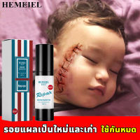 HEMEIEL ครีมลบรอยแผลเป็น ปรับปรุงรอยแผลเป็น แผลเป็นถลอก แผลเป็น แผลเป็นผ่าตัด แผลไฟไหม้ น้ำร้อนลวก ครีมรอยแผลเป็น เจลลบรอยแผลเป็น ครีมทาแผลนูน