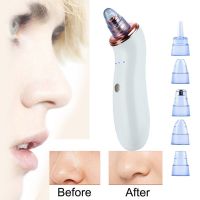 2023 New Blackhead Vacuum Acne Cleaner Pore Remover Electric Skin Cleanser Kit