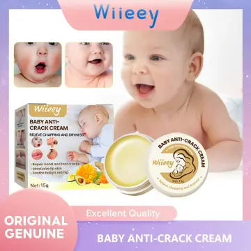 Kids Skin Whitening Cream Best Price in Singapore May 2024