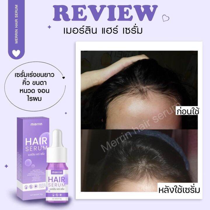 1-ขวด-merrin-hair-serum-เมอร์ลิน-แฮร์-เซรั่ม-เซรั่มปลูกขนตา-คิ้ว-หนวด-10g