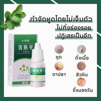 (จัดส่งทันที) แต้มหูดตาปลา ขจัดไฝและติ่งเนื้อ แบบถอนรากถอนโคน Wart Removal Corns Foot Care Solution