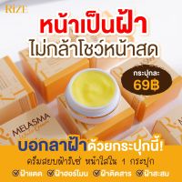 Rize MELASMA ครีมสยบฝ้า