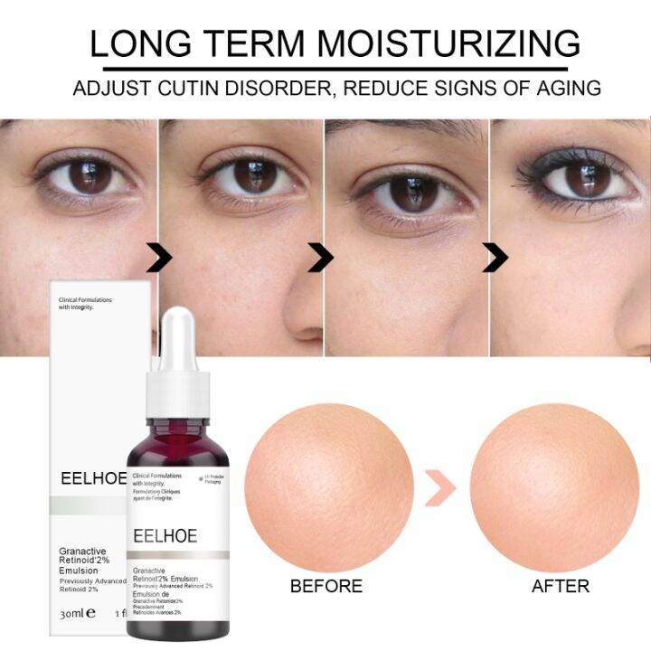 jt2204785jiao Salicylic Acid Mask Facial Serum AHA 30 2 salicylic