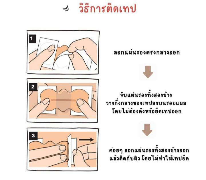 atofine-แผ่นแปะแผลเป็นคีลอยด์-จากญี่ปุ่น-size-s-m-l-ll-ราคาแบ่งขายต่อชิ้น