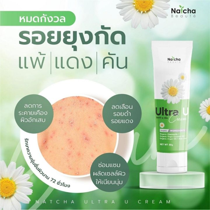 natcha-ultra-u-cream-อัลตร้า-ยู-ครีม-นัชชา-ณัชชา-สะเก็ดเงิน-ภูมิแพ้ผิวหนัง