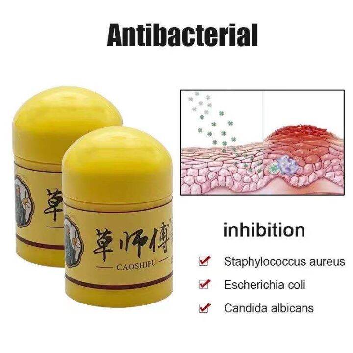 ☀CAOSHIFU Psoriasis Eczema Cream For Skin Problems Patch Body Massage ...