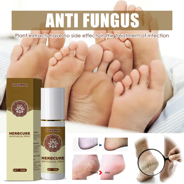 Very Effective HERBCURE ANTI FUNGAL SPRAY AntiFungal Infection