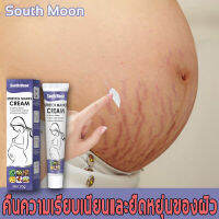 South Moon ครีมทาท้องลาย ยาทาท้องแตกลาย ยาแก้ท้องลาย ครีมขาแตกลาย ครีมทารอยแตกลาย ครีมลดรอยแตก ครีมรักษารอยแตกลาย ยาทาแก้ขาลายครีมลดรอยแตกลาย ครีมท้องแตกลาย ท้องแตกลาย ครีมรักษารอยแตก ครีมทาแตกลาย ครีมทาผิวแตกลาย ครีมรักษาขาลาย ครีมทาหน้าท้อง