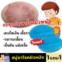 ส่งฟรี!! รีวิวเยอะมาก [1แถม1] สบู่ยา OKyoung โรคผิวหนัง สะเก็ดเงิน ผื่นผิวหนัง แพ้เหงื่อ กลากเกลื้อน 50กรัม ครีมทาผิวหนัง Sohappy66