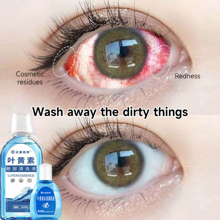 100 Safe and Effective Eye drops+Eye Wash Solution Care Liquid set Eye