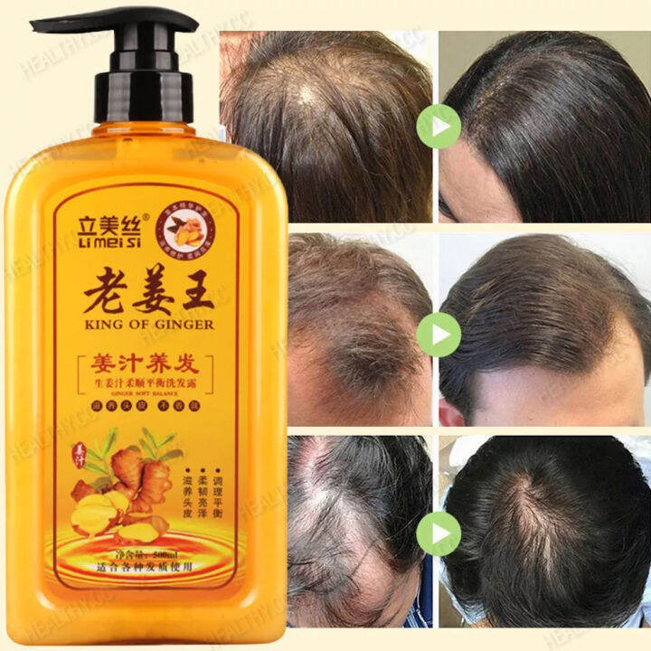 Original Ginger Hair Shampoo Anti Hair Loss Hair Growth Ginger Scalp Treatment Shampoo Oil 5141