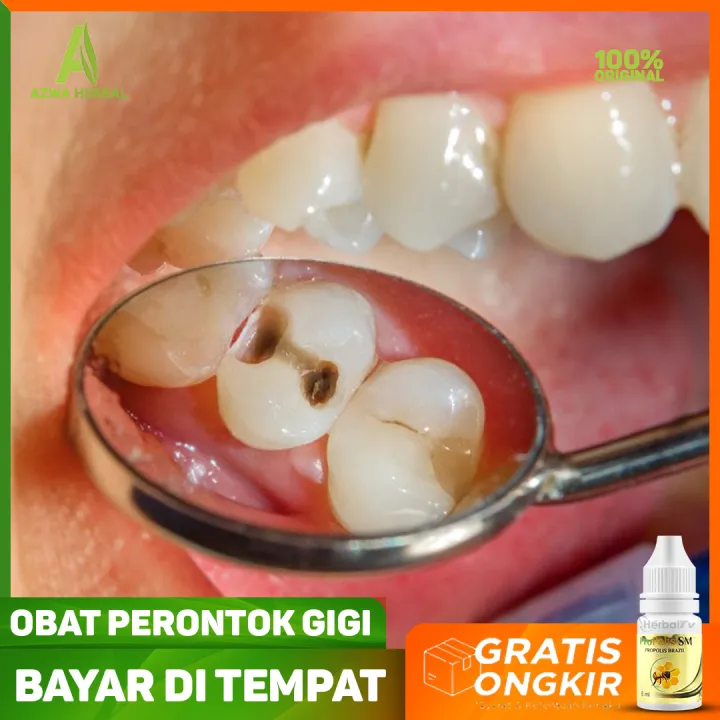 obat alami gigi berlubang dan ngilu