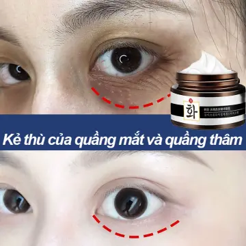 Có bất kỳ phương pháp nào khác để trị thâm mắt ngoài việc sử dụng kem trị thâm mắt Cha Skin?
