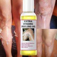 Exfoliating Oil Peeling Oil น้ำมันสีเหลืองดำสำหรับนิ้วมือข้อศอกเข่า