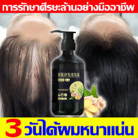 ?3วันได้ผมหนาแน่น? แชมพูแก้ผมร่วง 300ML สูตรสารสกัดจากขิง แชมพูเร่งผมยาว เร่งการเจริญเติบโตของเส้นผมและป้องกันผมร่วง แชมพูปลูกผม  ควบคุมความมัน ต้านเชื้อแบคทีเรีย รากผมแข็งแรง ของแท้ 100% แชมพูขิงเพียว ยาสระผมแก้ร่วง แซมพูลดผมร่วง