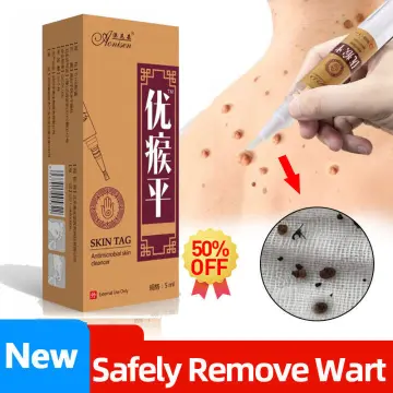 3ml Tags Moles Remover Warts Corn Remover Pen Skincare L0P3