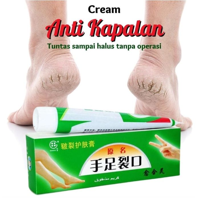 Obat Kaki Penghalus Kulit Rusak Salep Kaki Gatal Bernanah Salep Kaki ...