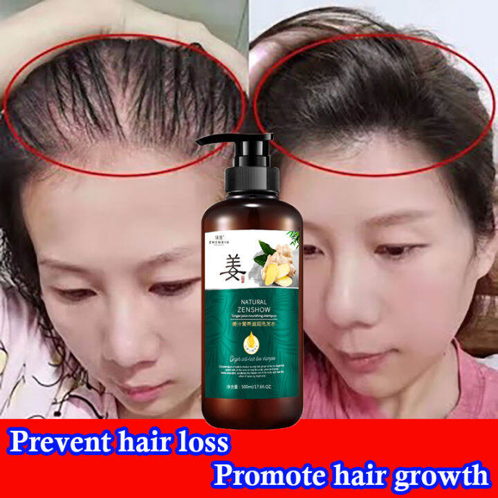 hair-growth-shampoo-500ml-original-ginger-anti-hairloss-shampoo-prevent