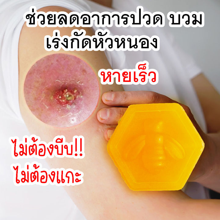 สบู่กำจัดฝีน้ำมันมนต์-8-ทิศ-กัดหัวฝีหนองอักเสบ-สมานแผลปิดโพรงฝี-ฟอกทำความสะอาดฝีทุกชนิด-ฆ่าเชื้อแบคทีเรียตรงจุด-ลดปวดบวมอักเสบ