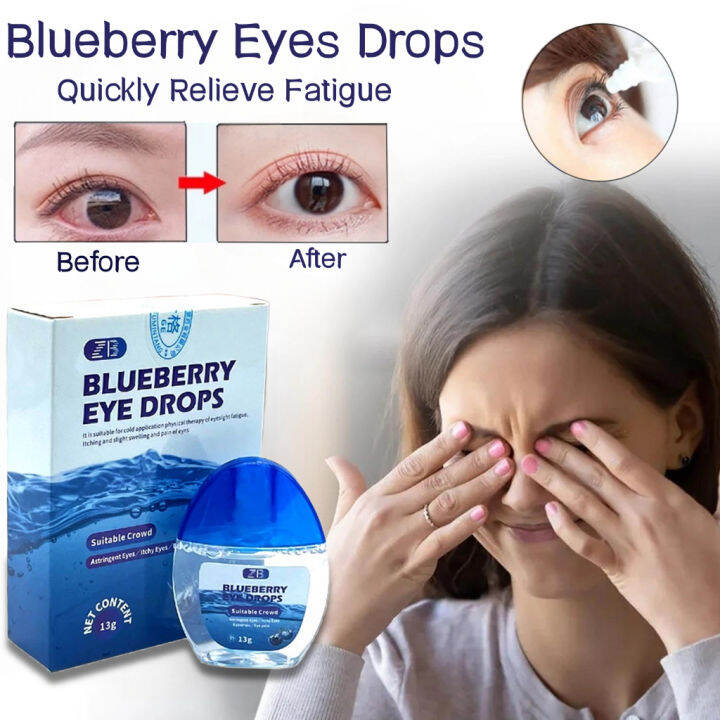 Blueberry Eye Drops Relieves Red Eyes Itchy Dry Eyes Sore