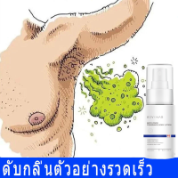 ดับกลิ่นรักแร้ ดับกลิ่น สเปรย์ใช้แทนโรลออน ระงับกลิ่นกาย สำหรับคนที่มีปัญหา กลิ่นตัว กลิ่นเท้า กลิ่นเต่า กลิ่นรักแร้ สเปรย์ดับกลิ่นกาย ลดเหงื่อรักแร้ ดับกลิ่นตัว สเปรย์ดับกลิ่นตัว ระงับกลิ่นเต่า ลูกกลิ้งรักแร้ สเปรย์ระงับกลิ่นกาย สเปรย์ สเปรย์ระงับกาย