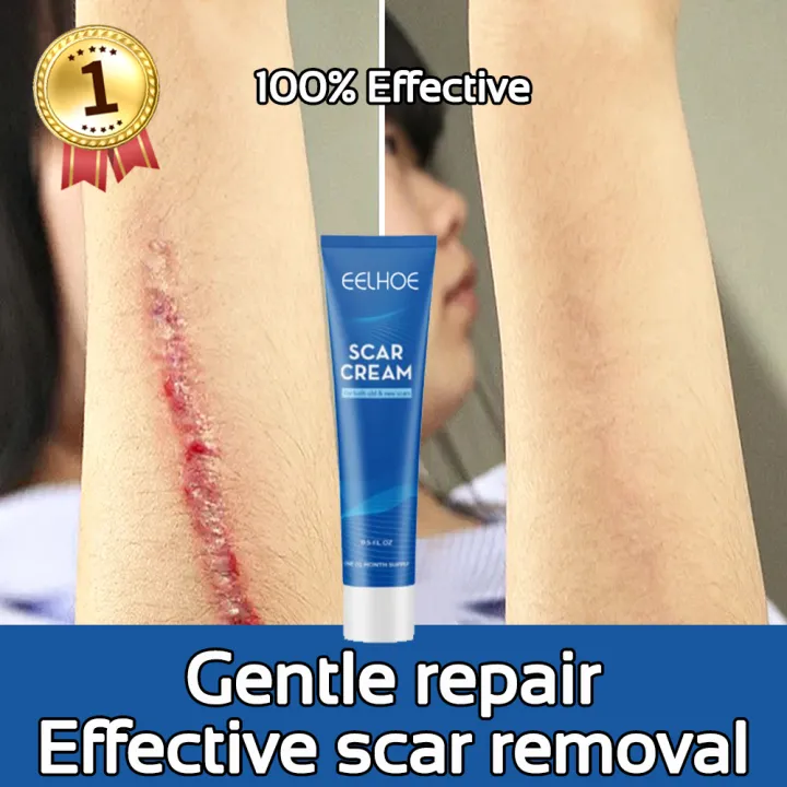 🔥NEW！🔥Scar cream 60g scar remover for kids Remove old and new scars