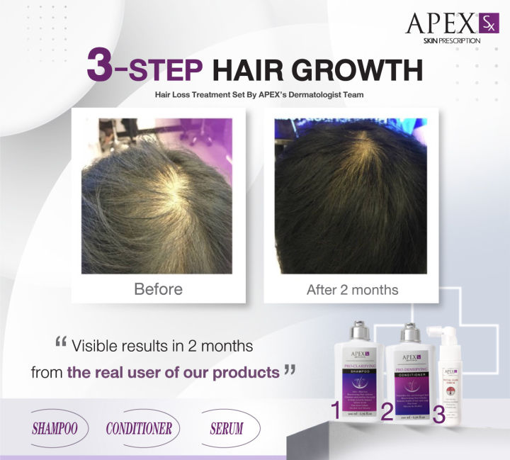 3-step-hair-growth-ชุด-สระ-นวดพ่น-ชุดลดผมร่วงกระตุ้นการงอกใหม่ของเส้นผม