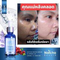 ณัชชา โบเต้ ไวท์เซรั่ม เซรั่มสูตรเข้มข้น Natcha White Serum 30ml