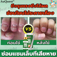 【ตัวช่วยดีๆ ในการฟื้นฟูเล็บ 】West&amp;Month เชื้อราเล็บมือ 30ml ซ่อมเล็บ ซ่อมแซมเล็บ เซรั่มทาเล็บ เซรั่มซ่อมเซมเล็บ รักษาเชื้อราที่เล็บ ยาทาเล็บ แก้ไขปัญหาเล็บหักง่าย น้ำมันบำรุงเล็บ ดูแลเล็บ บำรุงเล็บ รักษาเล็บเล็บบาง เล็บเท้า เล็บมือ Nail Repair Essence