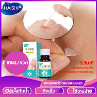 ป้องกันแบคทีเรีย วางพลาสเตอร์ Liquid Dressing สำหรับครอบครัว หยุดเลือดBand-Aids สร้างฟิล์ม ฆ่าเชื้อได้ดี ผิวแผลป้องกันเมมเบรน ผ้าพันแผลกันน้ำวงดนตรีช่วยเหลือ วางพลาสเตอร์ Sterileพลาสเตอร์ พลาสเตอร์ปิดแผล Liquid Band-Aid