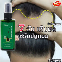 【สินค้านำเข้า】ZENSHOW น้ำยาปลูกผม สเปรย์ปลูกผม (แชมพูขิงบริสุทธิ์, ผมร่วง, ยาแก้ผมร่วง, แชมพูขิง, แชมพูแก้ผมร่วง, เอสเซ้นส์ผมร่วง, เอสเซ้นส์การเจริญเติบโตของเส้นผม, แชมพูปลูกผม, แชมพูสมุนไพร, แชมพูผมร่วง, ผมร่วงแซมโบ, แชมพูขิง, ผมร่วง)