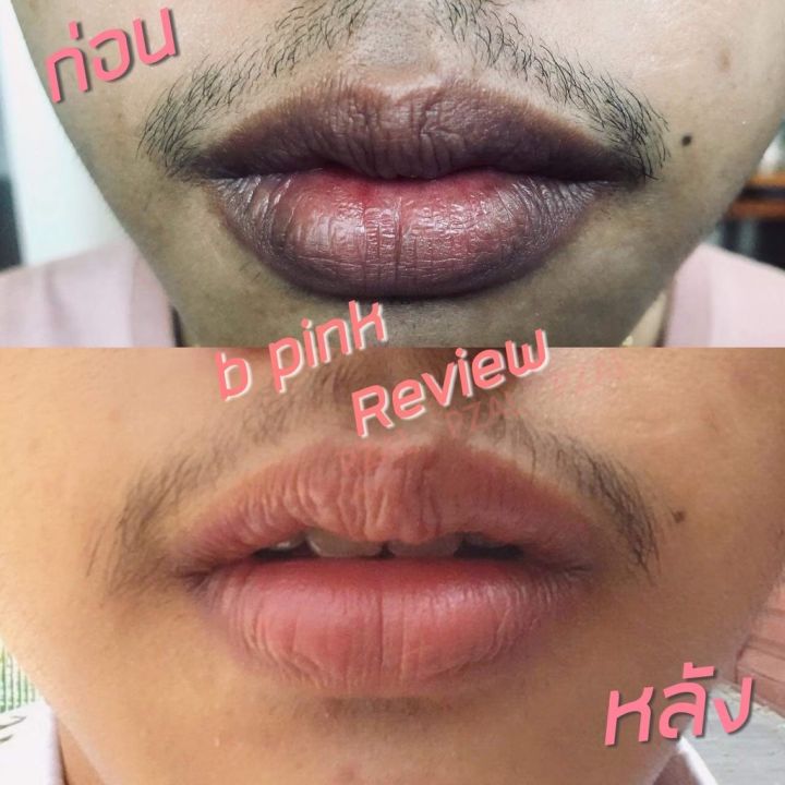 แพ็กคู่คุ้ม-b-pink-lip-ลิปครีมปากชมพู-หัวนมชมพู-เปลี่ยนสีผิวให้ชมพูอย่างเป็นธรรมชาติ