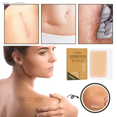 6Pcs/Box Tattoo Hidden Tape Healthy Painless Mild Safe Waterproof Easy to Use Gentle Scar Tattoo Covering Patch for Girl