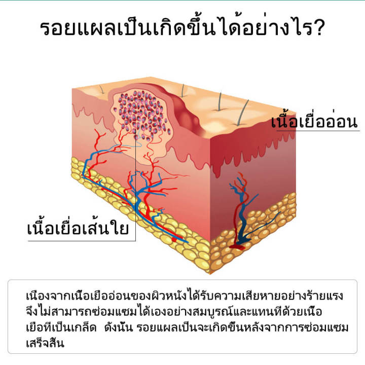 breylee-ของแท้-ครีมลบแผลเป็น-แผลเป็น-ครีมทารอยแผลเป็น-ไฟไหม้แผลน้ำร้อนลวกแผลผ่าตัดเป็นต้นแผลเป็นหลายประซ่อมแซมผิวที่เสียหาย-บำรุงผิวให้แข็งแรง-เจลลบรอยแผลเป็น-scar-cream