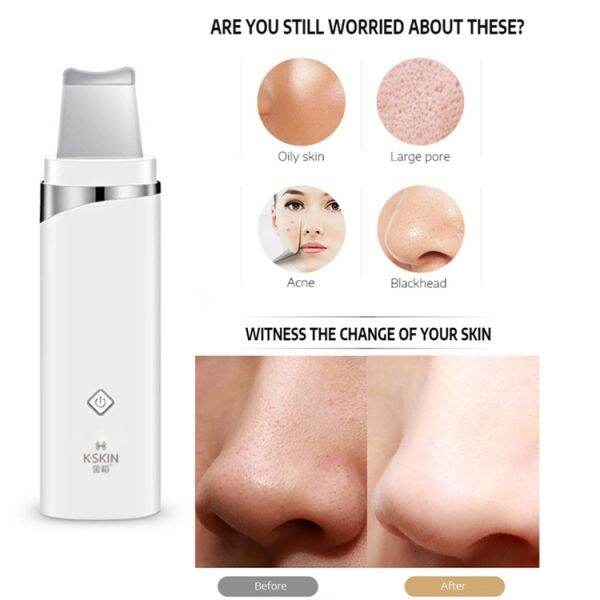 k-skin-kd-8023ultrasonic-กำจัดสิวเสี้ยนสิวหัวดำเครื่องดูดสิวดูแลผิวหน้าเครื่องถูเอ็กซ์โฟเลียติ้งเครื่องดูดสิว