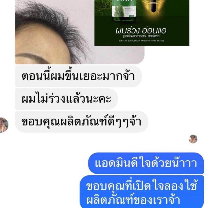 ของแท้-พร้อมส่ง-toby-horsetail-วิตามินลดผมร่วง-ผมบาง-หัวล้าน-อาหารเสริมบำรุงเส้นผม-หญ้าหางม้า-บำรุงผม-ผมแห้งเสีย-แตกปลาย-ผมมัน-ขาดหลุดร่วง-1-กระปุก-30-ซอฟเจล-290-ส่งฟรีปลายทาง