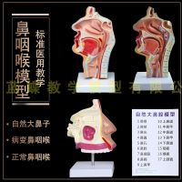 Human nose nasal anatomy model medical model otolaryngology human nose nasal cavity model