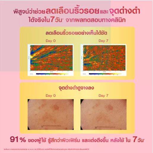 exp-08-2025-พอนด์ส-เอจ-มิราเคิล-อัลธีเมท-ยูธ-เซรั่ม-ผลัดเซลล์ผิว-เผยผิวดูอ่อนเยาว์-30-กรัม-ponds-age-miracle-ultimate-youth-serum-30-g