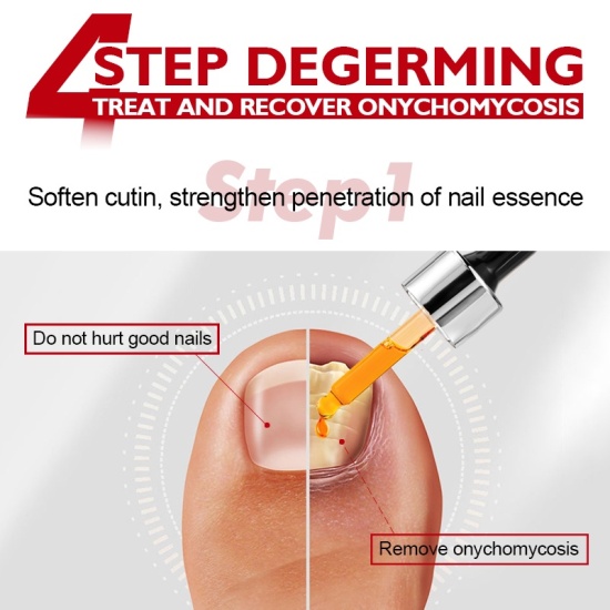 Vibrant glamour dưỡng móng tay dài và cứng nail repair serum fungal nail - ảnh sản phẩm 3